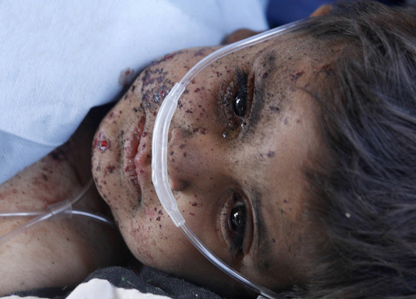 Afghan child injured